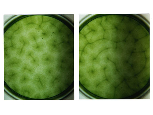 How to control pond algae