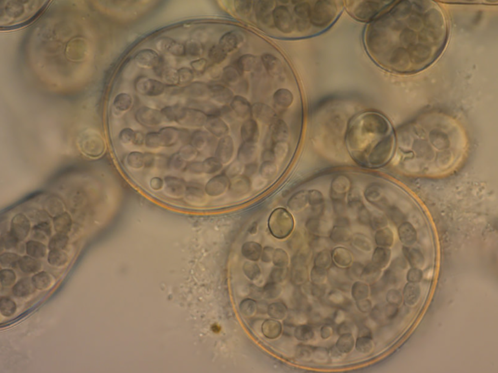 How to beat aquarium Cyanobacteria